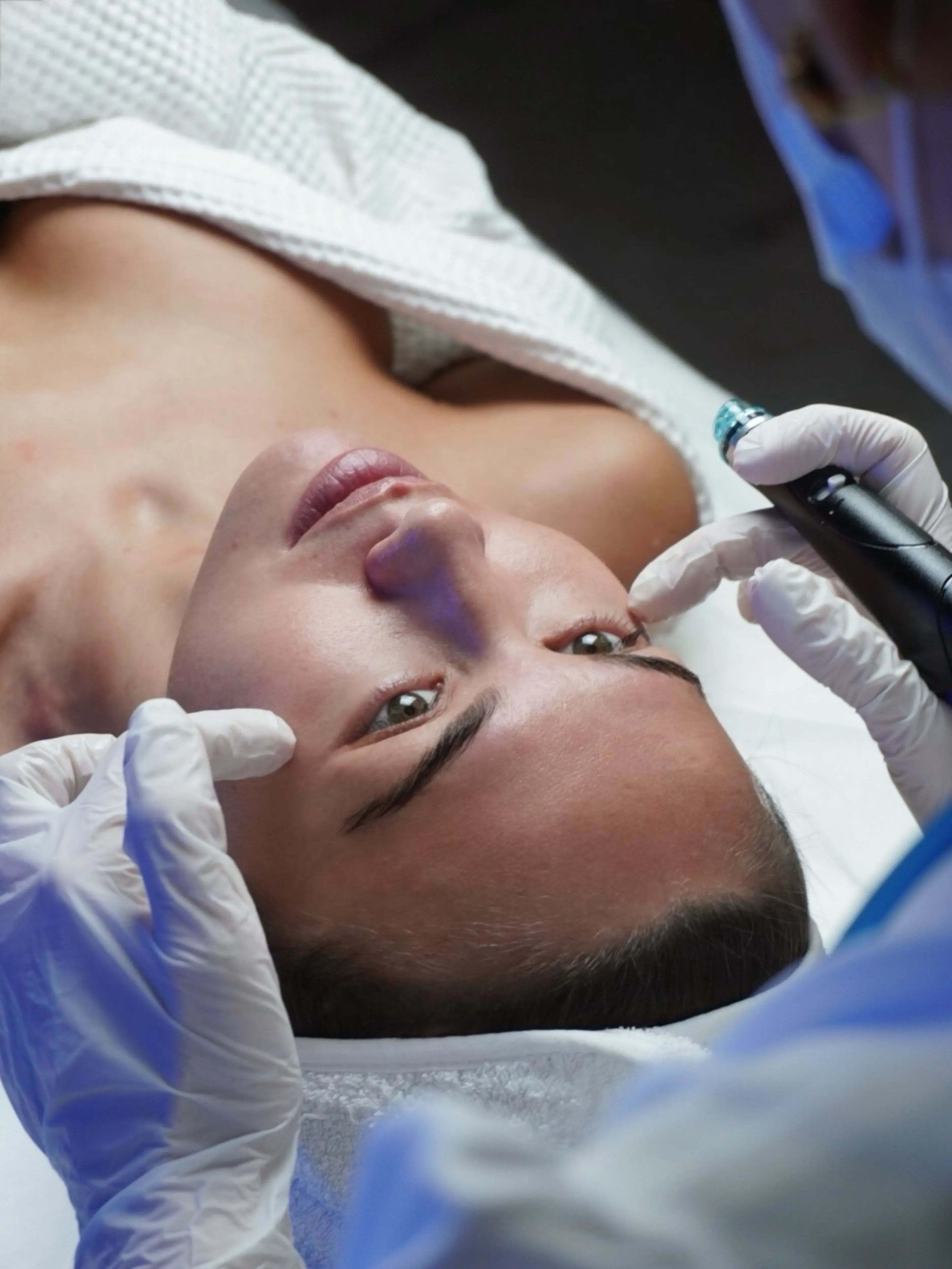 Гидропилинг HydraFacial