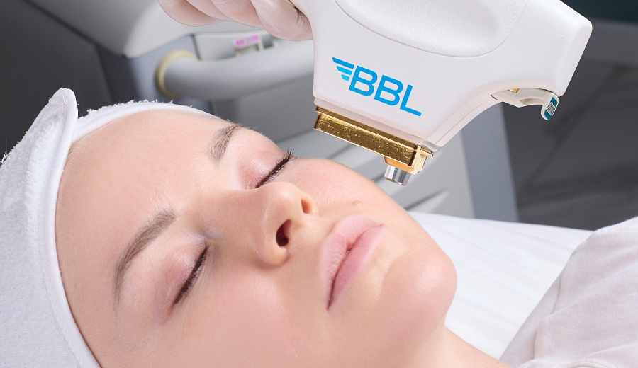 Фотоомоложение лица BBL